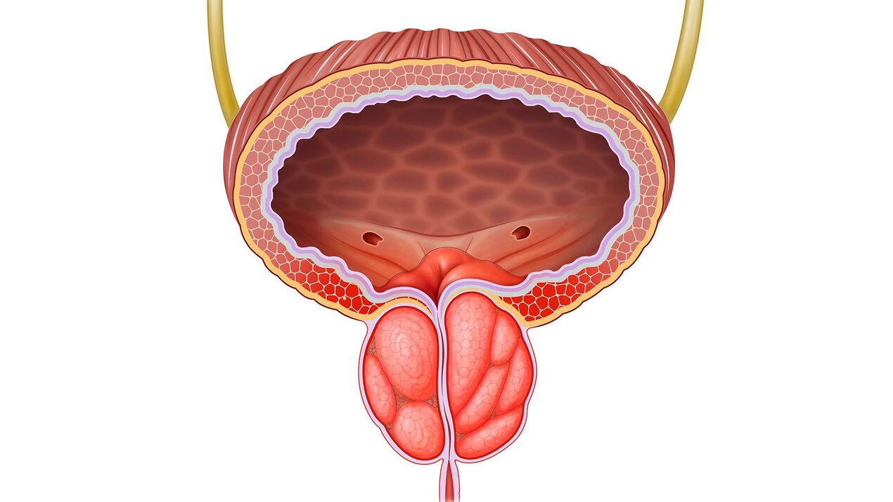 upaljene prostate